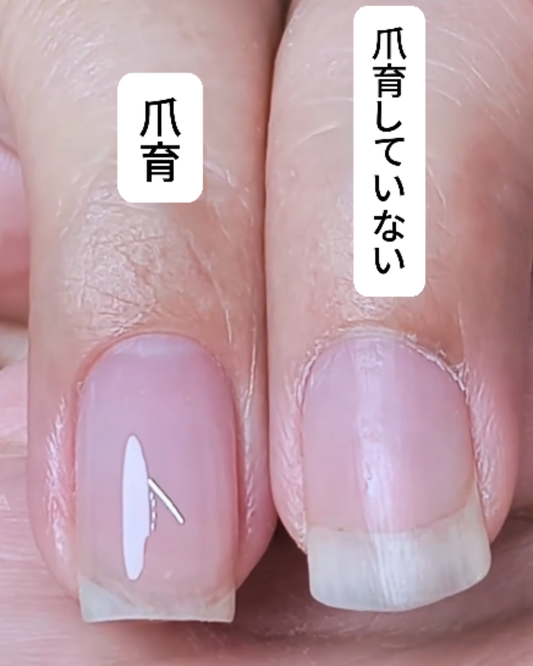 ネイルしたら爪がボロボロに見えるのはなぜ？爪まわりケアとネイルエッセンスペンの基本