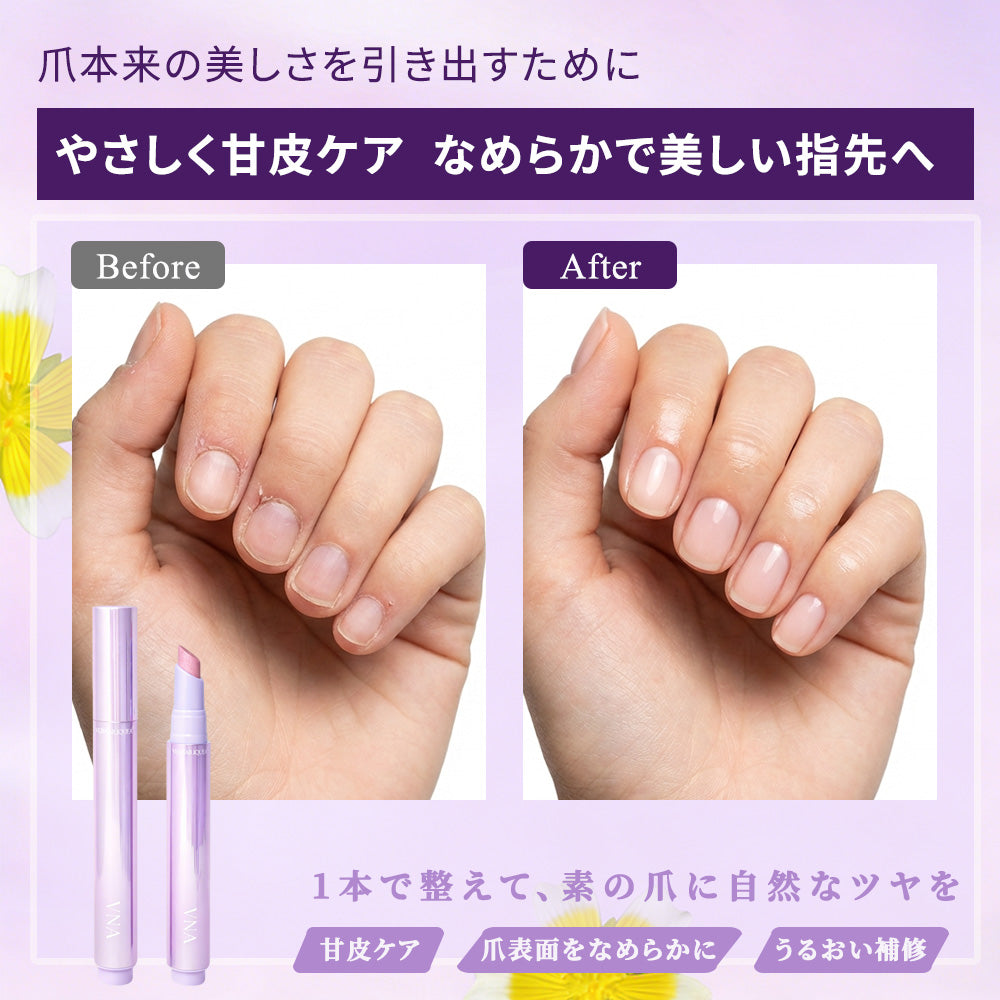 VNA Nail Essence Pen push type before and after nail care comparison